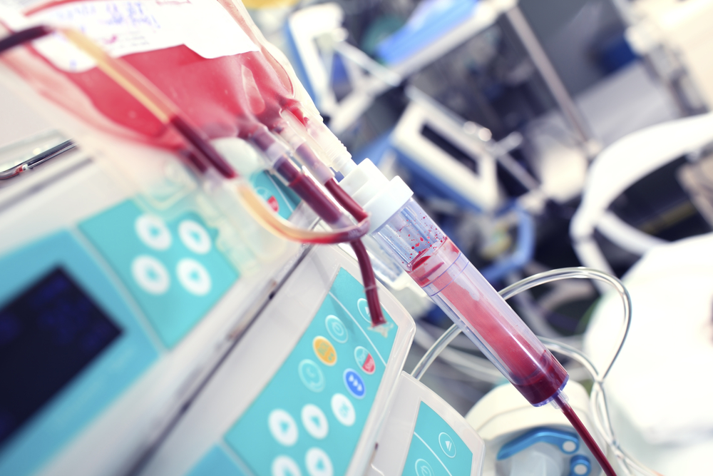 Risk of Cardiac Arrest in Patients on Dialysis Attributable to Inherited Factors