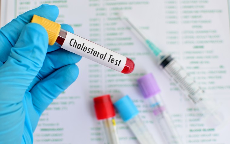 Trial discontinued for cholesterol drug evacetrapib
